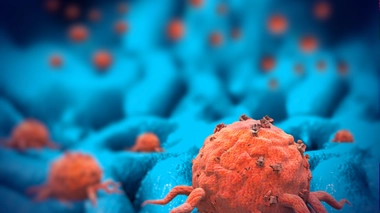 Les tumeurs neuroendocrines, des tumeurs rares et complexes