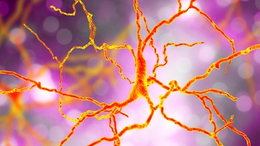 Maladie de Huntington : une affection neurologique incurable