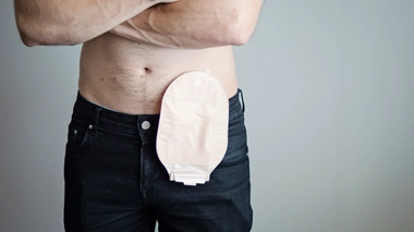 Comment faire l’amour quand on porte une poche de stomie ?