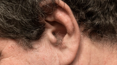 Poils dans les oreilles... comment s'en débarrasser ?