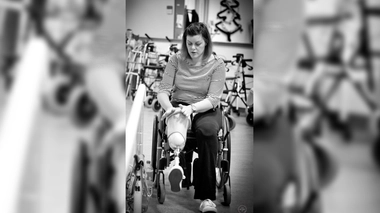 Choc toxique : Sandrine a été amputée à cause de sa coupe menstruelle