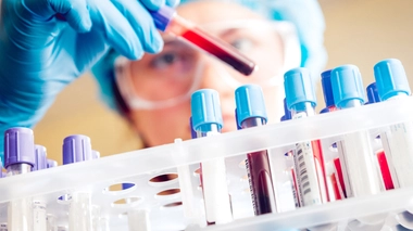 Image d'illustration