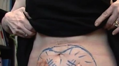 Ch@t : En guerre contre la cellulite