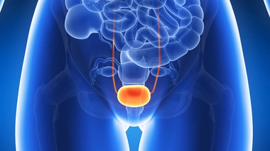 Tout savoir sur le cancer de la vessie