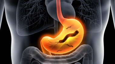 Ulcère : comment dépister l'Helicobacter pylori ?