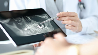 Un dentiste cassait les dents saines de ses patients pour mieux les réparer