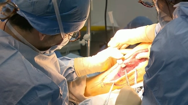 Cancer de la mâchoire : une reconstruction grâce à l'autogreffe