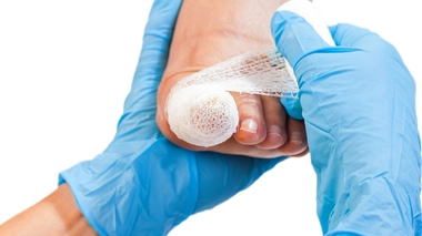 Ongles : quand il faut opérer en urgence