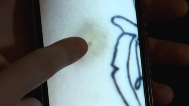 Les plaintes pour piqûres en boite de nuit augmentent partout en France 