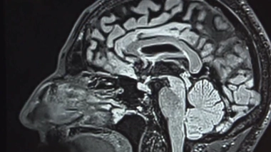 Les mystères du bégaiement bientôt élucidés ?