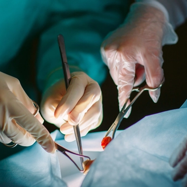 La greffe, du prélèvement à la transplantation