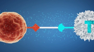 Lymphome résistant : l'espoir d'un nouveau traitement