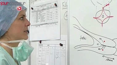 Ch@t : La fausse couche