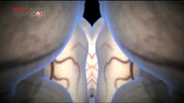 Des cellules souches pour mieux comprendre la schizophrénie