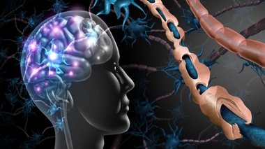 Depuis quand existe la sclérose en plaques ?