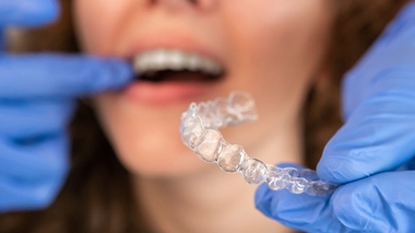 Des marques proposent sur Internet des gouttières transparentes pour redresser les dents