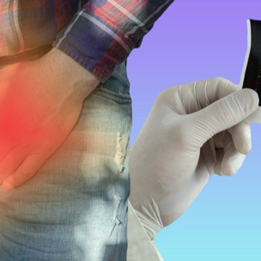 Adénome de la prostate : fréquent mais bénin