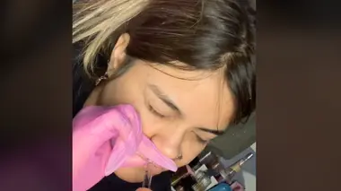 Acide hyaluronique : halte aux injections clandestines !