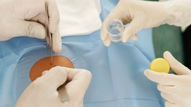 Y a-t-il des risques et des contre-indications à la biopsie ?