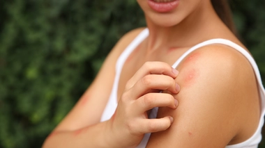 Existe-t-il vraiment des peaux à moustiques ?