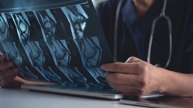 Sarcome des tissus mous : l'importance d'un diagnostic précoce