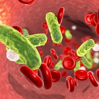 La septicémie ou sepsis : quand les germes envahissent l'organisme