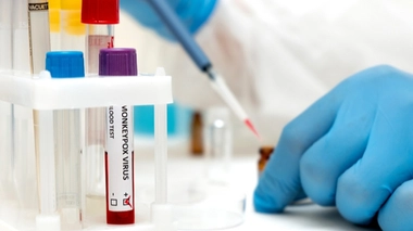 Une triple infection unique pour les scientifiques