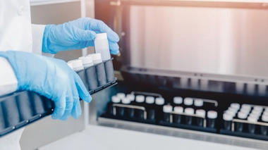 Le donneur devra divulguer son identité, si l'enfant né de ce don le demande