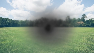 DMLA, quatre lettres pour désigner la Dégénérescence Maculaire Liée à l'Âge