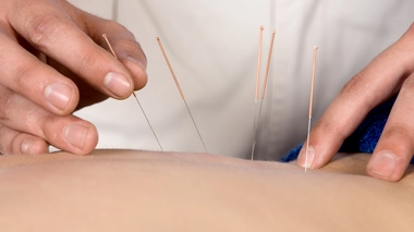 L'acupuncture est une discipline millénaire
