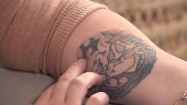 Détatouage chimique : attention danger