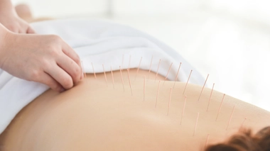 Plusieurs études récentes montrent que l’acupuncture est efficace pour certains effets secondaires des traitements du cancer