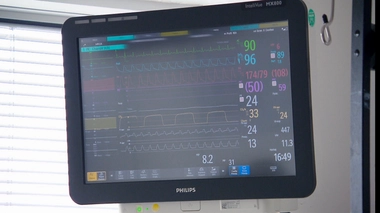 Réanimation : diminuer le bruit des alarmes pour mieux soigner