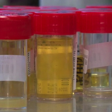 L'urine : des vertus moins connues