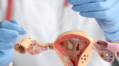 Stérilisation féminine : pour les femmes sûres de leur choix