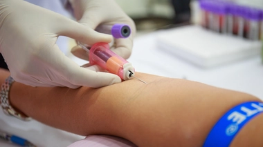 Plus de 55 millions de personnes dans le monde souffrent de démence, un nombre qui devrait grimper à 130 millions d'ici 2050 avec l'augmentation de l'espérance de vie, selon l'Organisation mondiale de la santé (OMS)