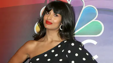Quelle est cette maladie rare qui déforme le visage de Jameela Jamil ?