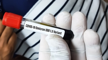 Aux États-Unis, XBB.1.5 se répand actuellement 12% plus vite que les autres variants en circulation, selon le Centre européen de prévention et de contrôle des maladies (ECDC)