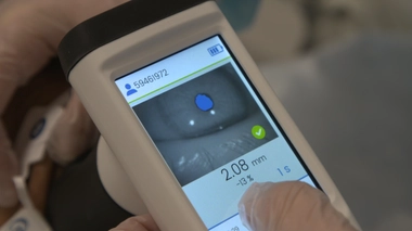 En réanimation, l'état du cerveau se lit... dans les pupilles