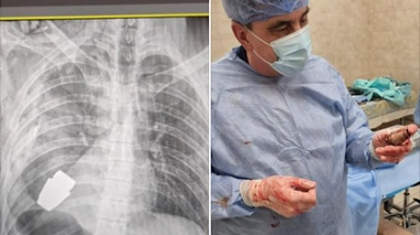 Le chirurgien assisté par des démineurs a retiré l'engin explosif du thorax du soldat.