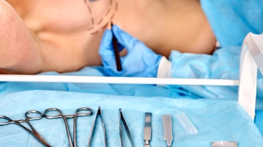 Cancer du sein : l'ablation et la reconstruction en une seule opération