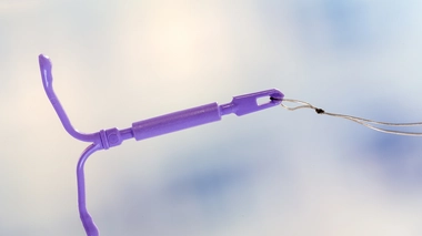 Les DIU hormonaux seraient associés à un risque légèrement accru de dépression