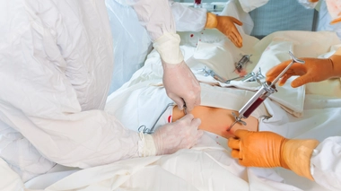 VIH : un deuxième patient considéré comme "guéri" dans le monde