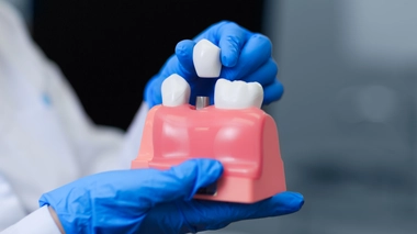 La mission de l'orthoprothésiste est de redonner à ses patients la possibilité de marcher