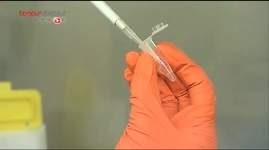 Lupus : à la recherche de nouveaux traitements