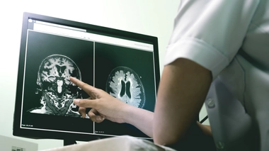 L'homme de 53 ans a été admis en soins intensifs après avoir été victime d'un AVC