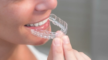 Des gouttières pour des dents bien alignées !