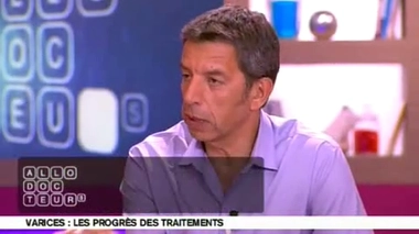 Varices : supprimer une veine ?