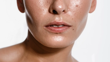 Acné : qu'est-ce que le sébum ?