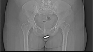 La jeune femme a été conduite en urgence dans un hôpital de la capitale